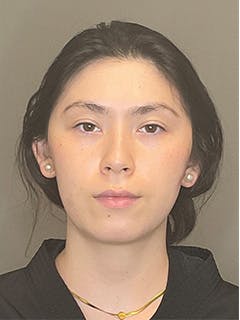 BioRePeel Before & After Gallery - Patient 180915 - Image 1