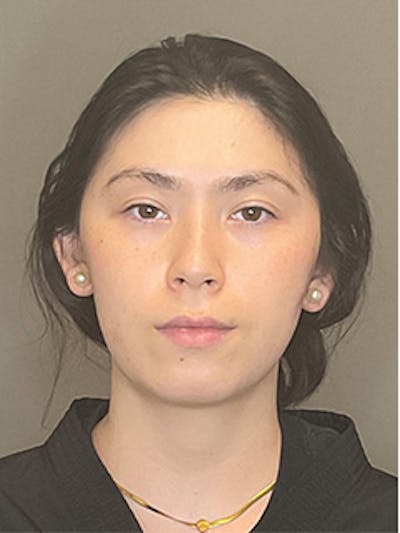 BioRePeel Before & After Gallery - Patient 180915 - Image 1