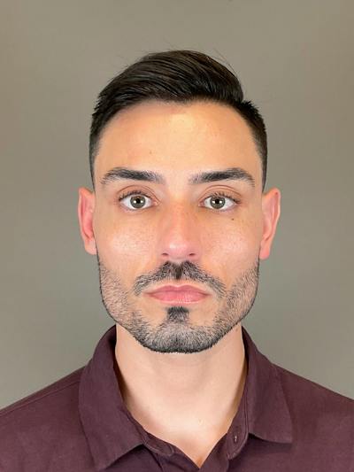 Sculptra Before & After Gallery - Patient 320418 - Image 1