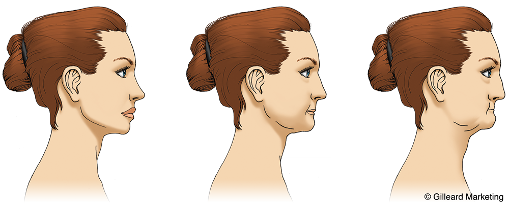 Dentures Infographic