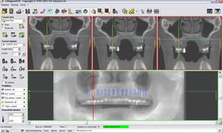 X Ray