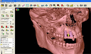 X Ray