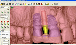 X Ray
