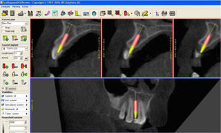 X Ray