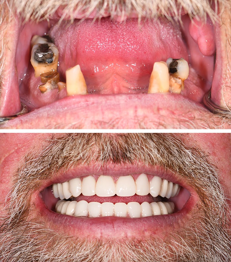 Grand River Dental