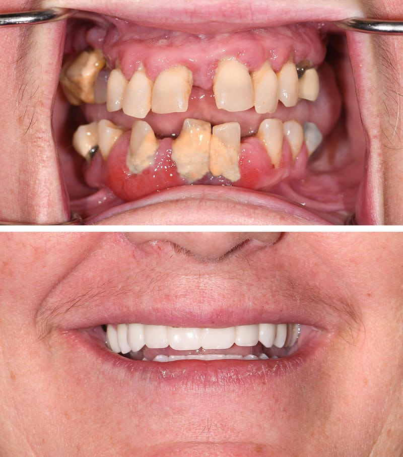Grand River Dental
