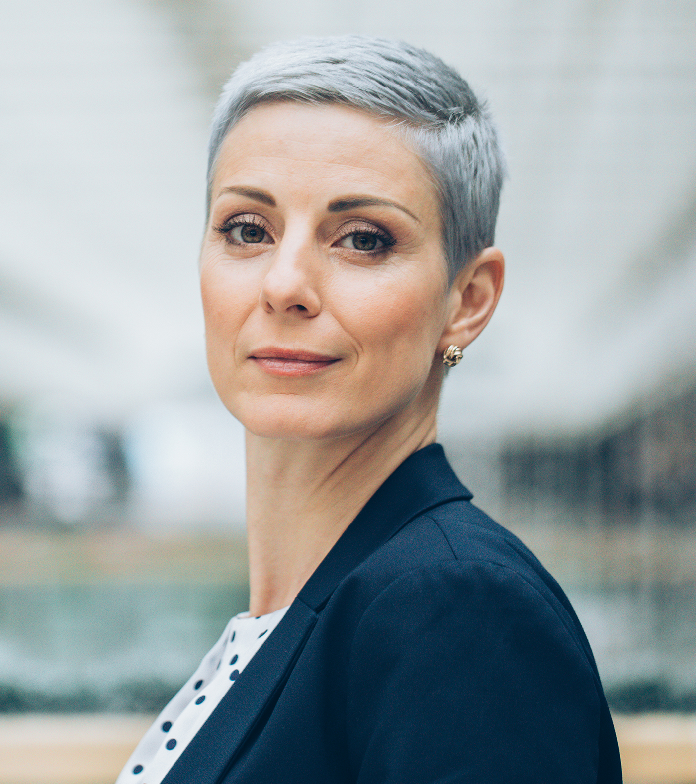 Megan Fox'S Shocking Transformation: Forehead Reduction Revealed? - trnvk2y