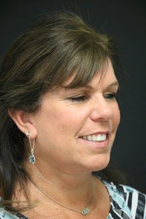 Facelift Incisions