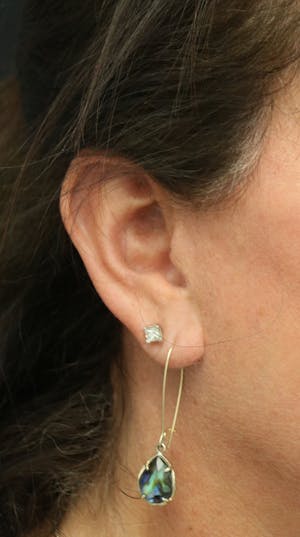 Facelift Incisions