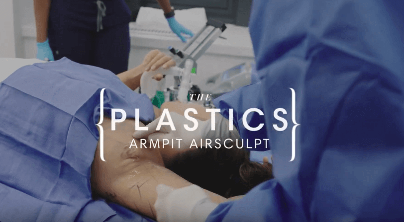 plastics armpit airsculpt