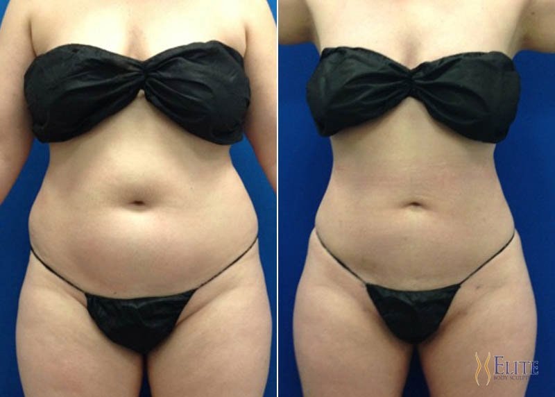 Tummy Display