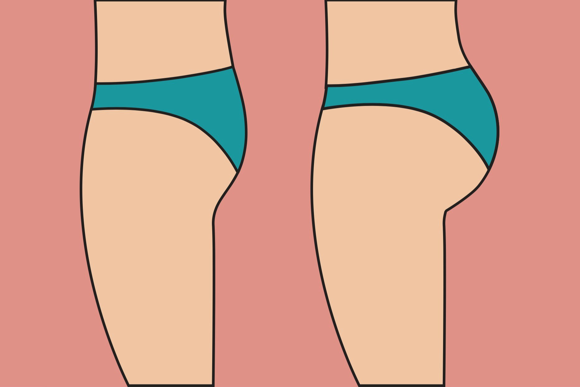 Butt before and after fat transfer