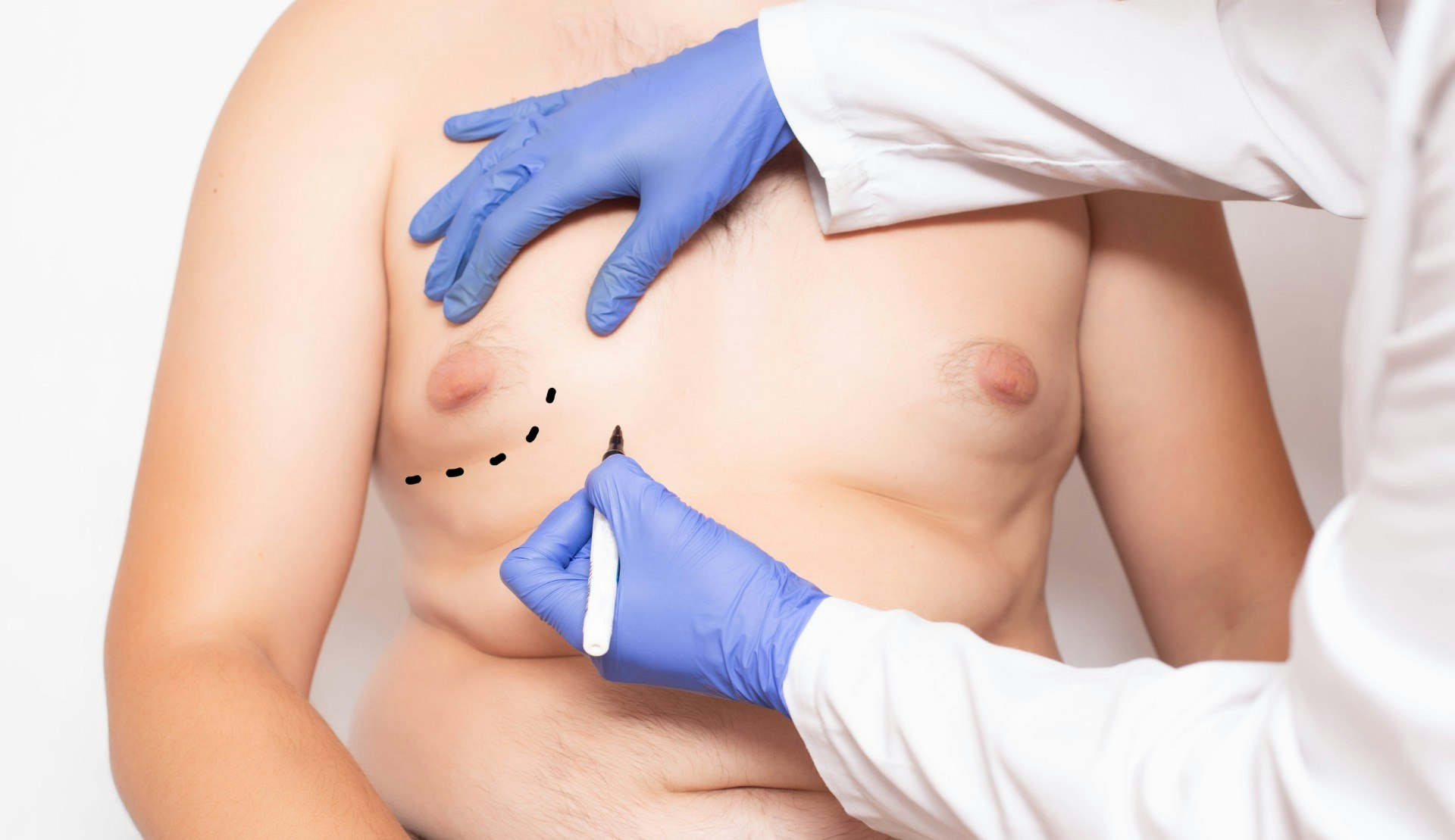 Doctor marking pacient body