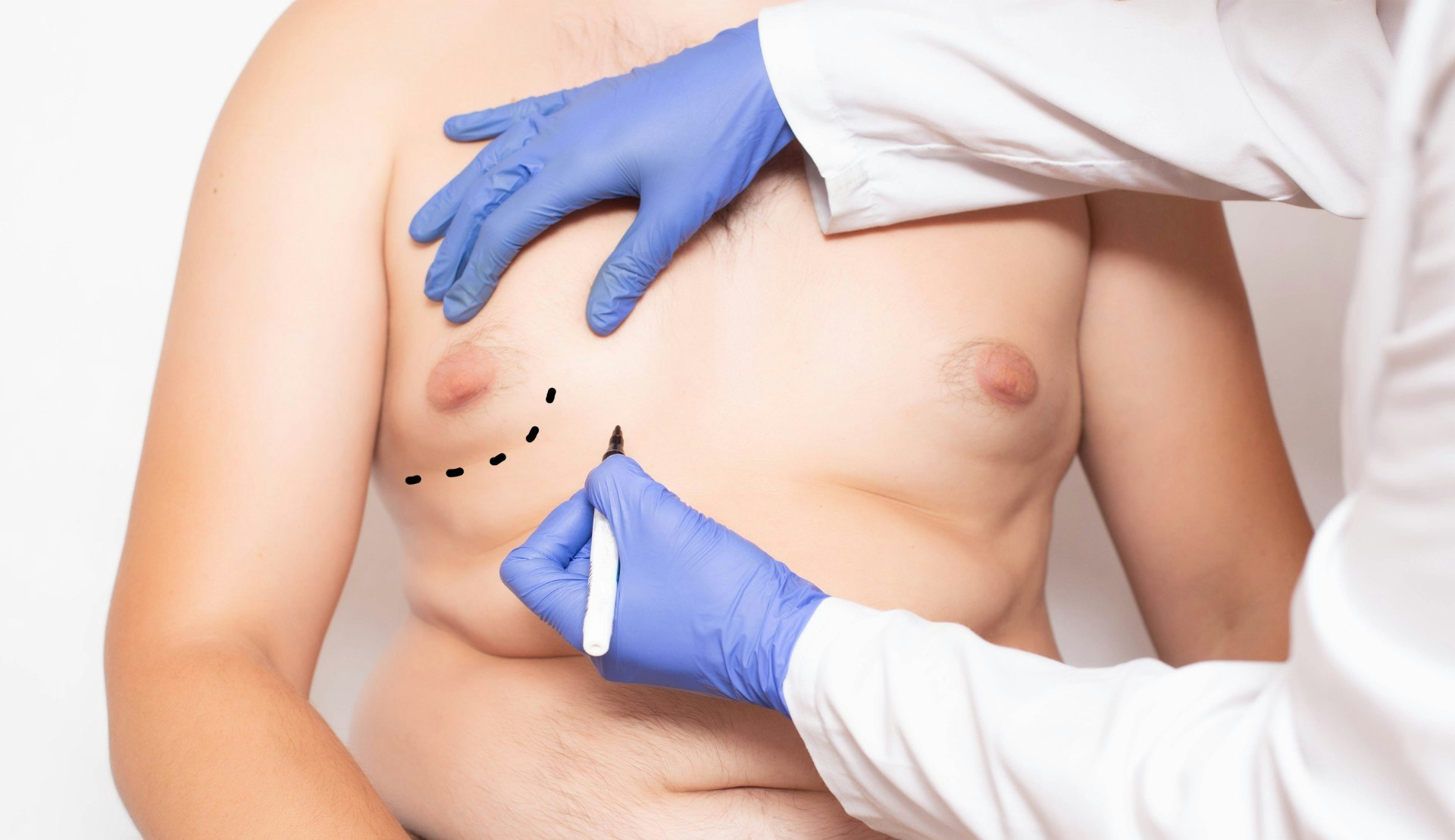 Minimally Invasive AirSculpt® — New York's Best Gynecomastia Treatment and  Liposuction Alternative