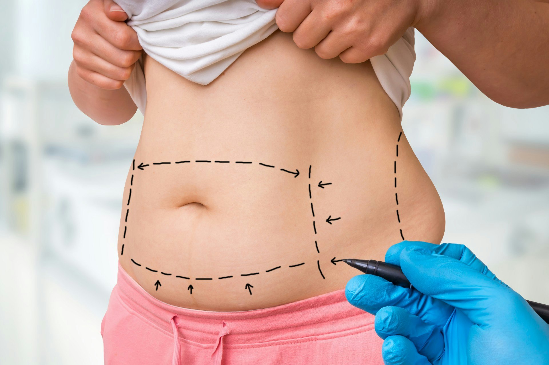 Doctor marking pacient body