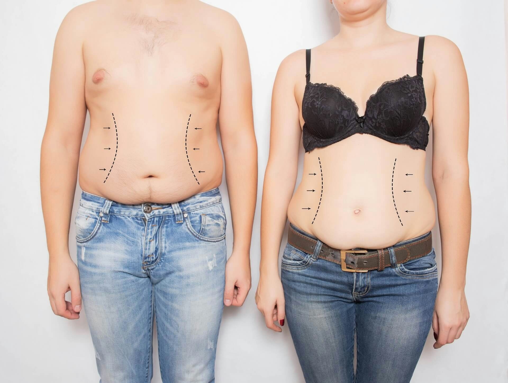 Man and woman side to side with stomach marked