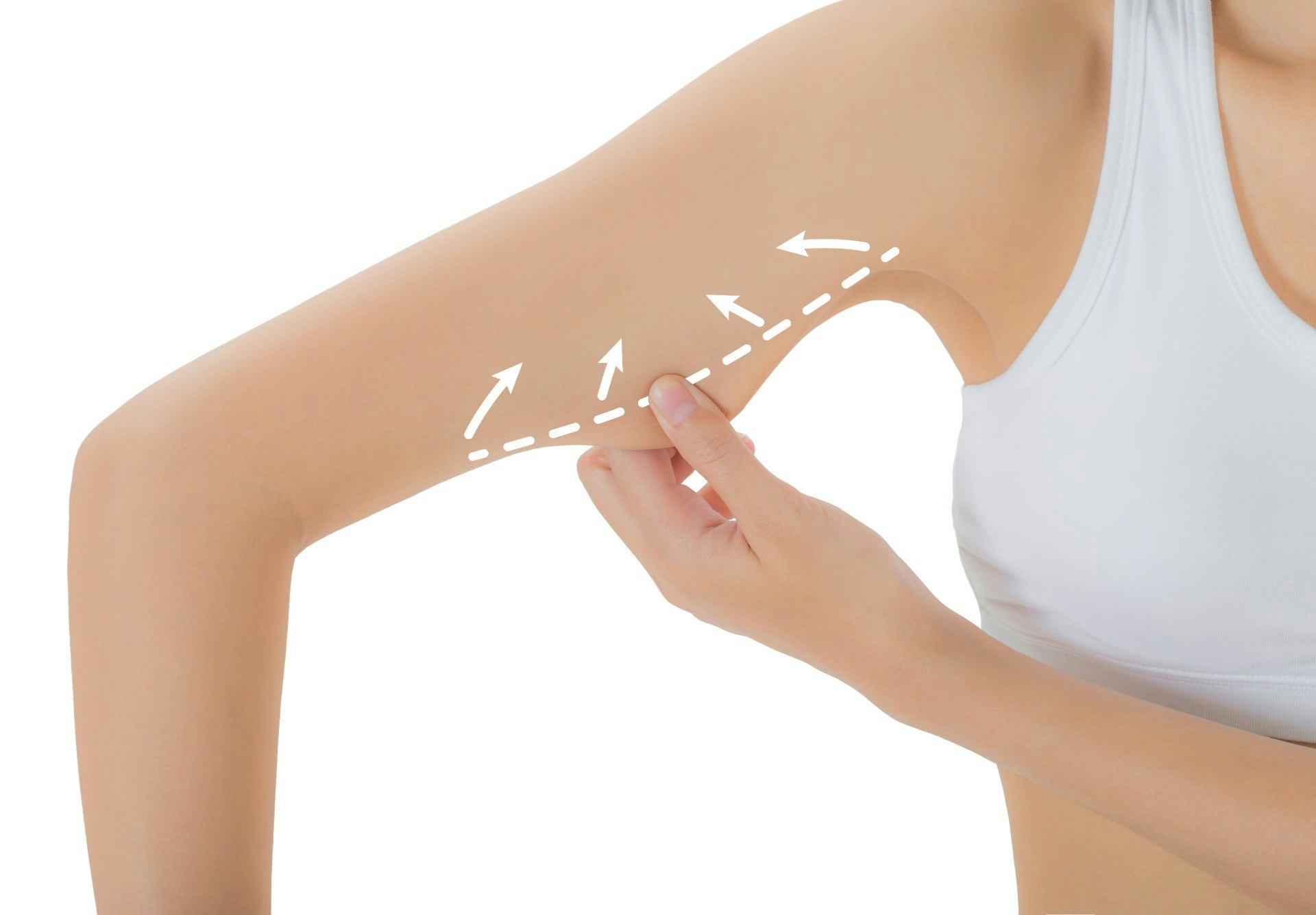 Woman pinching her arm
