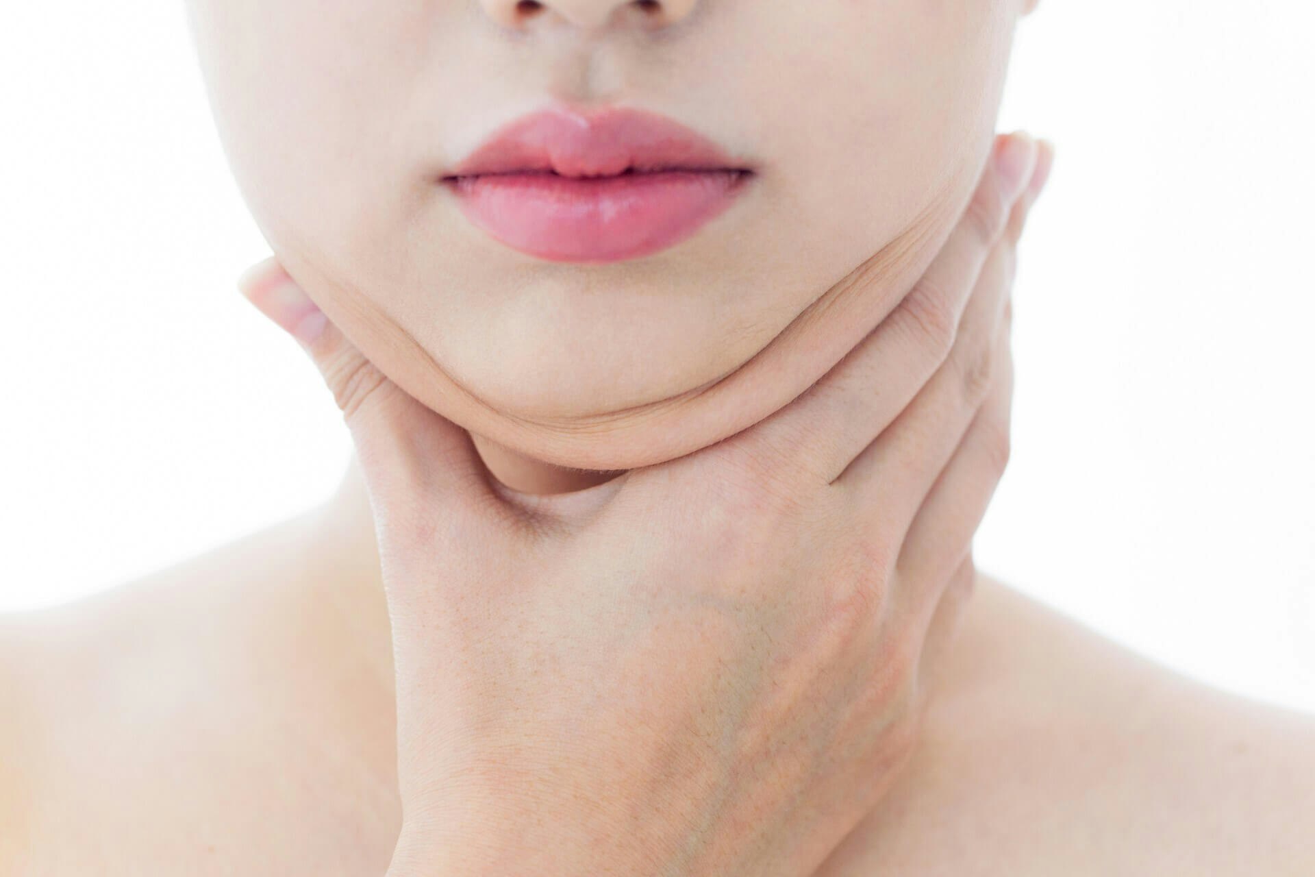 Liposuction vs. Kybella in Minneapolis: Remove Chin Fat Safely With This Alternative