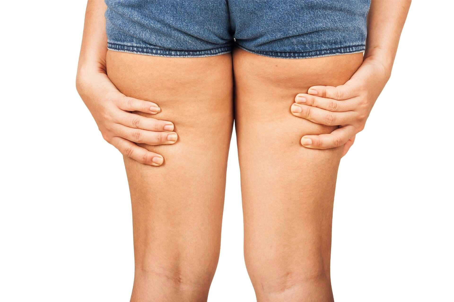 How to Prevent Jeans from Wearing Out in the Inner Thighs