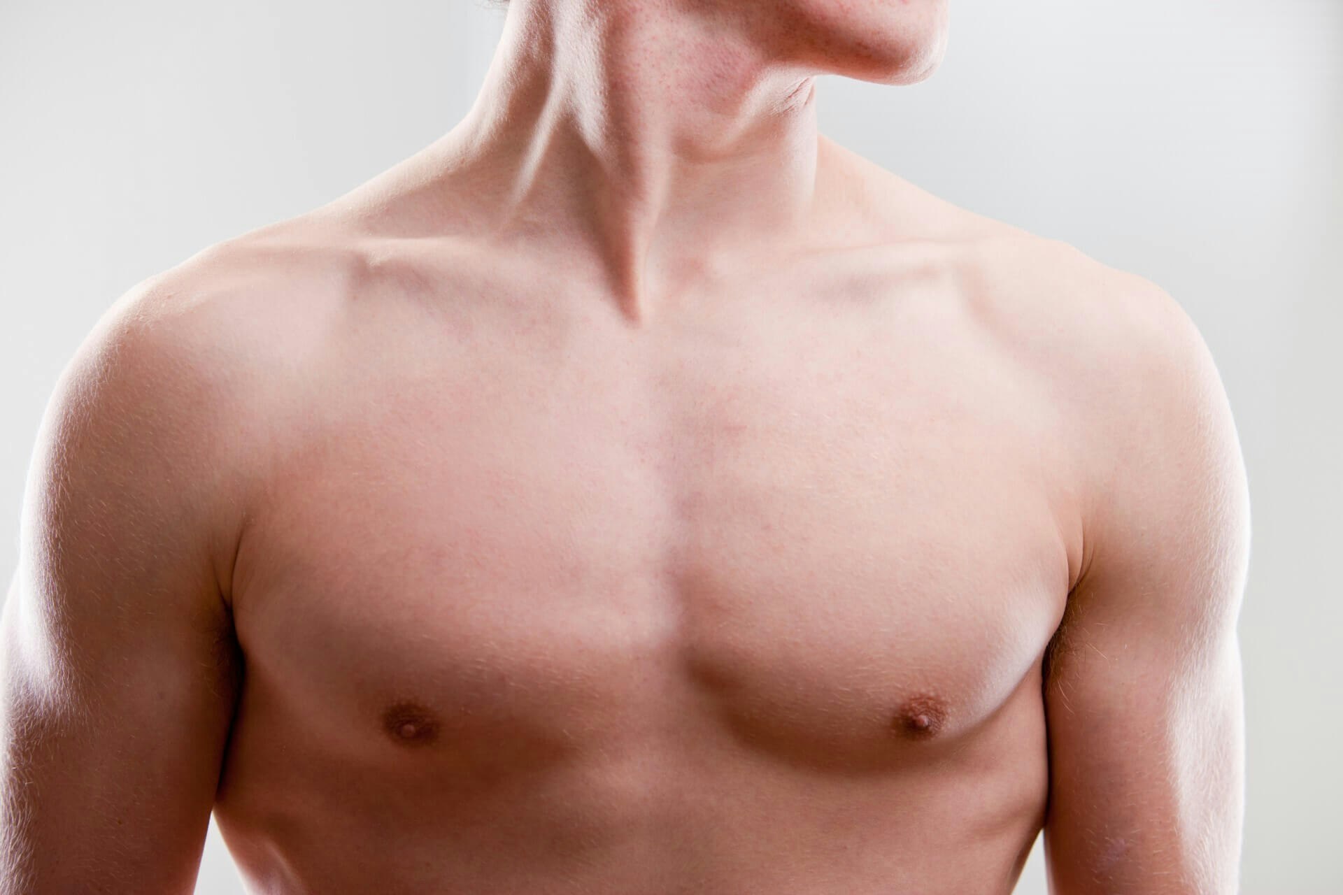 Male Chest Reduction  AirSculpt® Gynecomastia Treatment