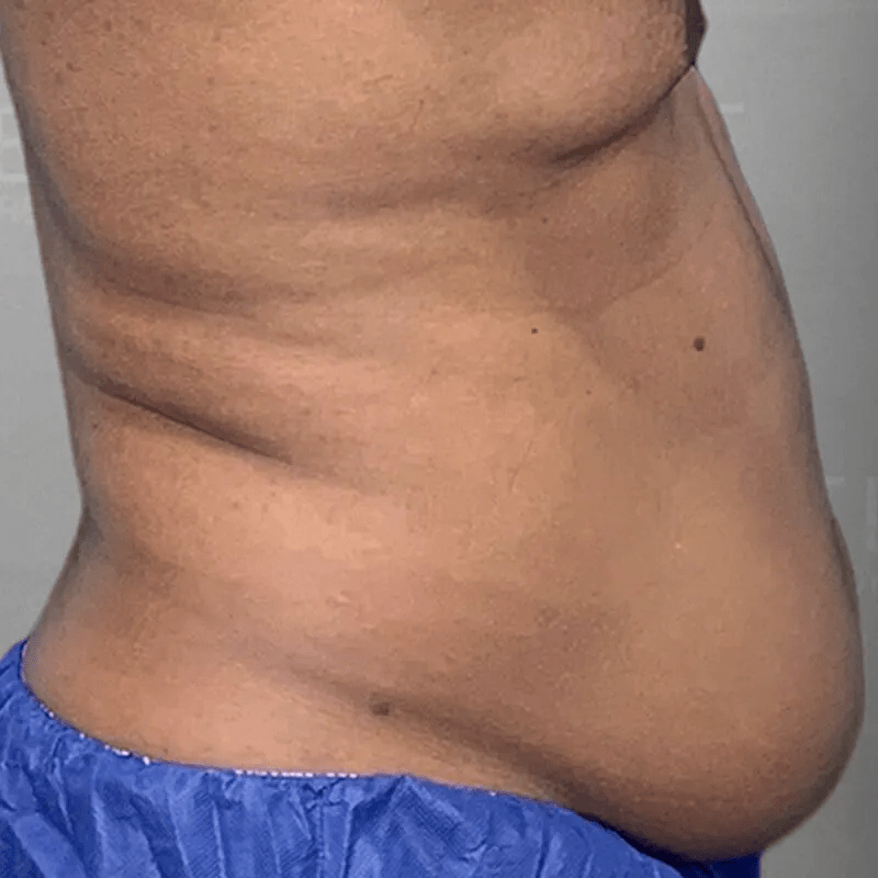 48-Hour Six Pack Before