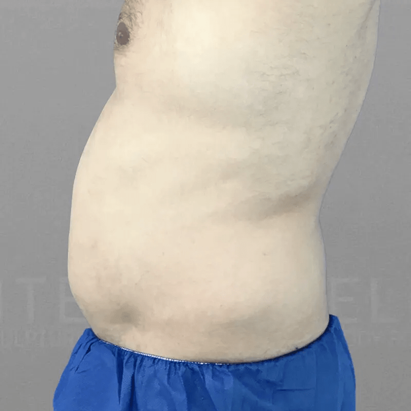 48-Hour Six Pack Before