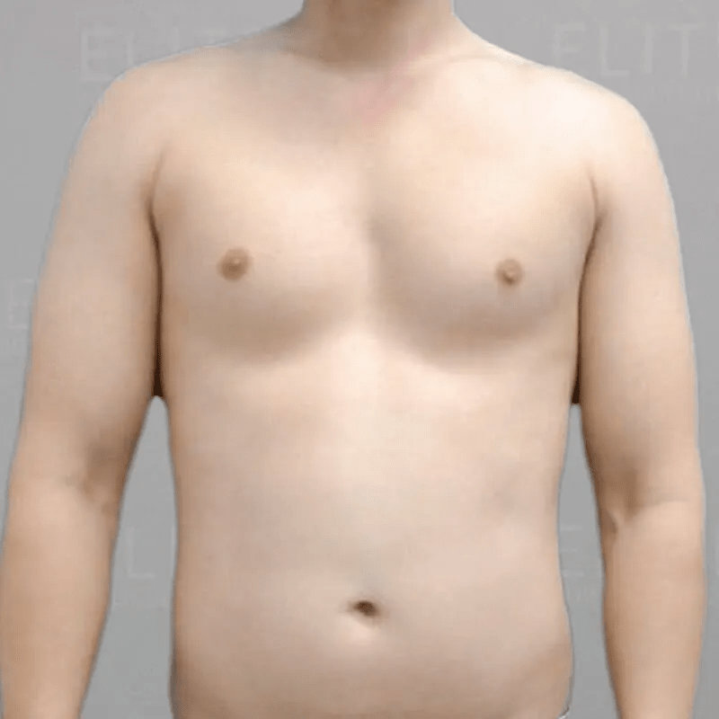 48-Hour Six Pack Before