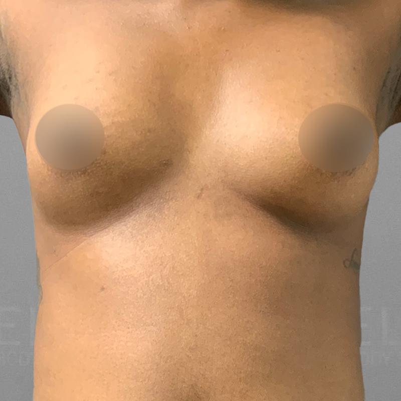 before airsculpt up a cup