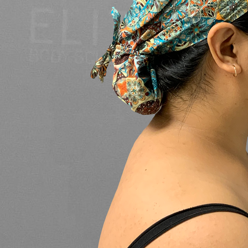 after buffalo hump airsculpt