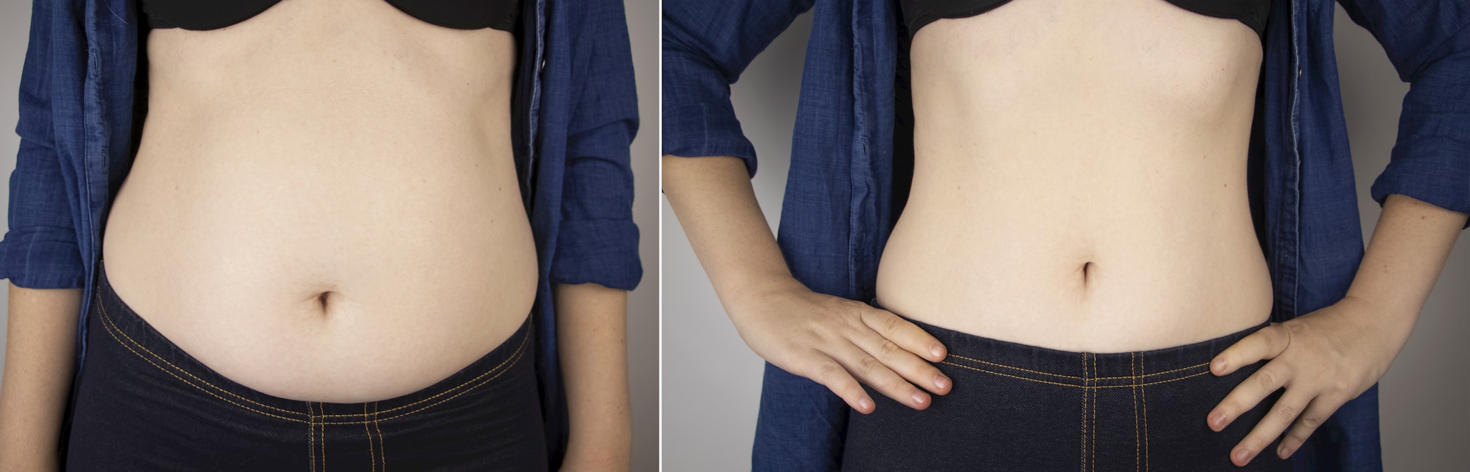 Stomach before and after losing fat