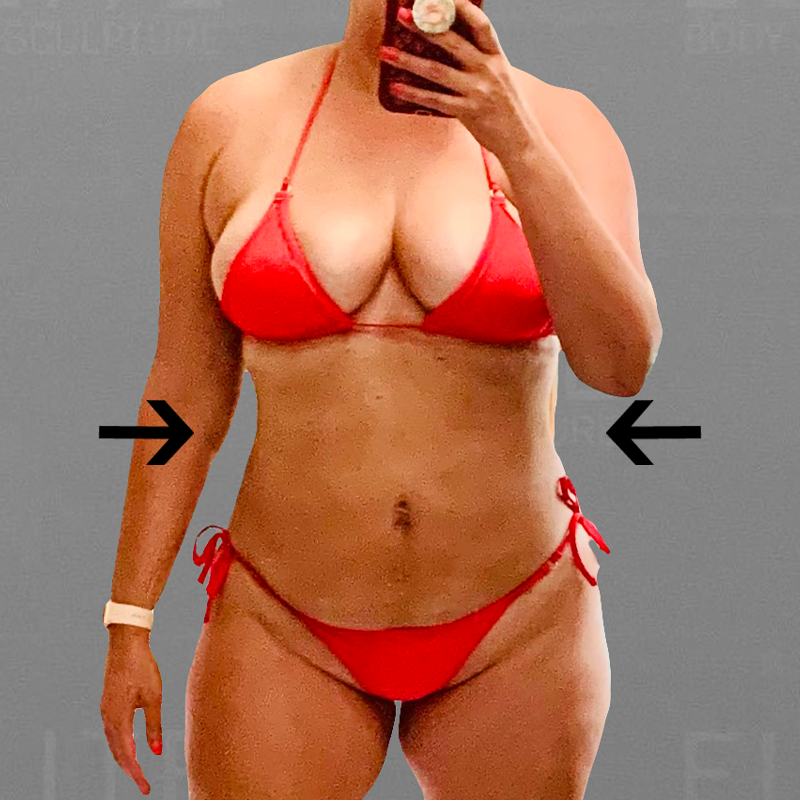after full ab airsculpt