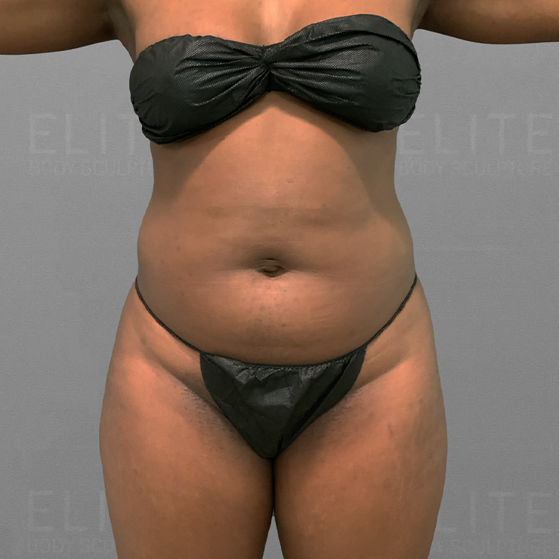 Raro front before