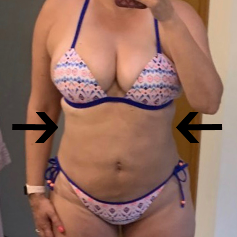melissa front after