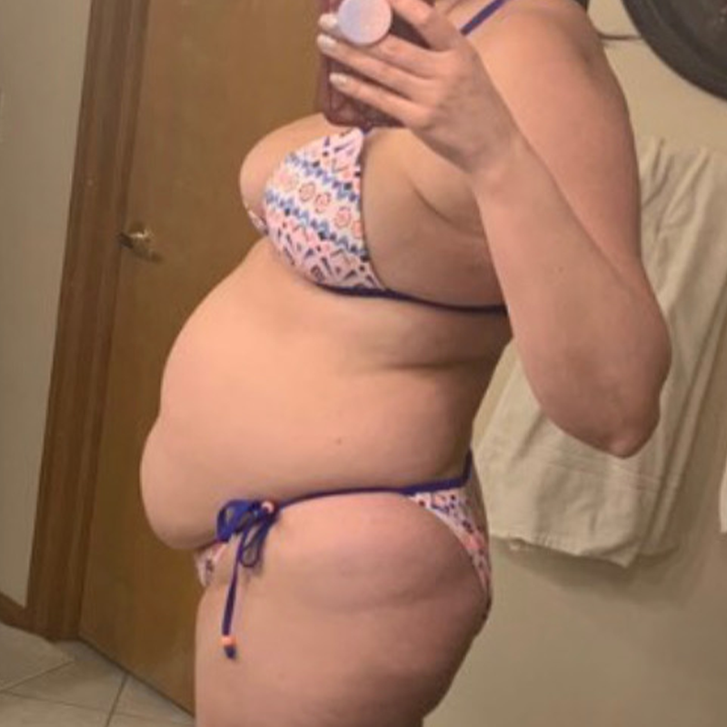 melissa side before