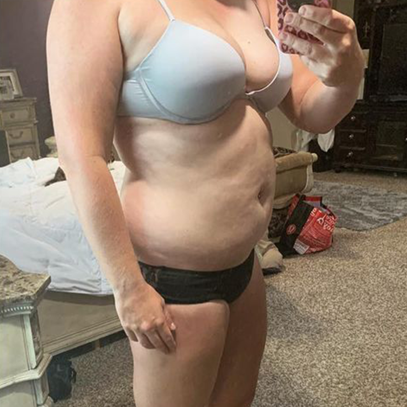 Kaitlyn Ab AirSculpt Before