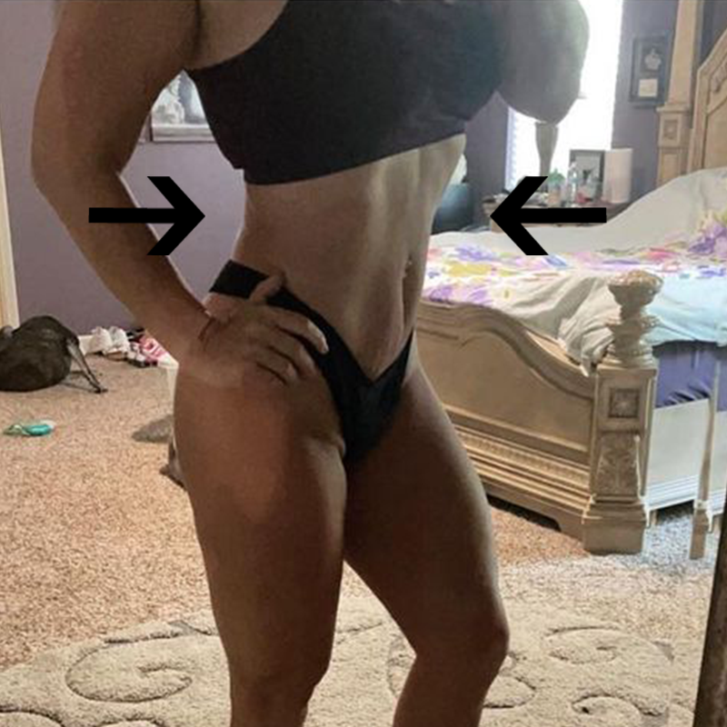 Kaitlyn Ab AirSculpt After