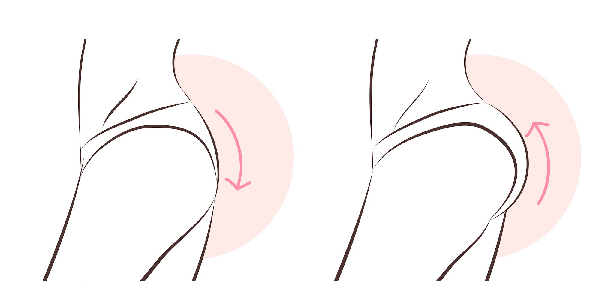 illustration of BBL