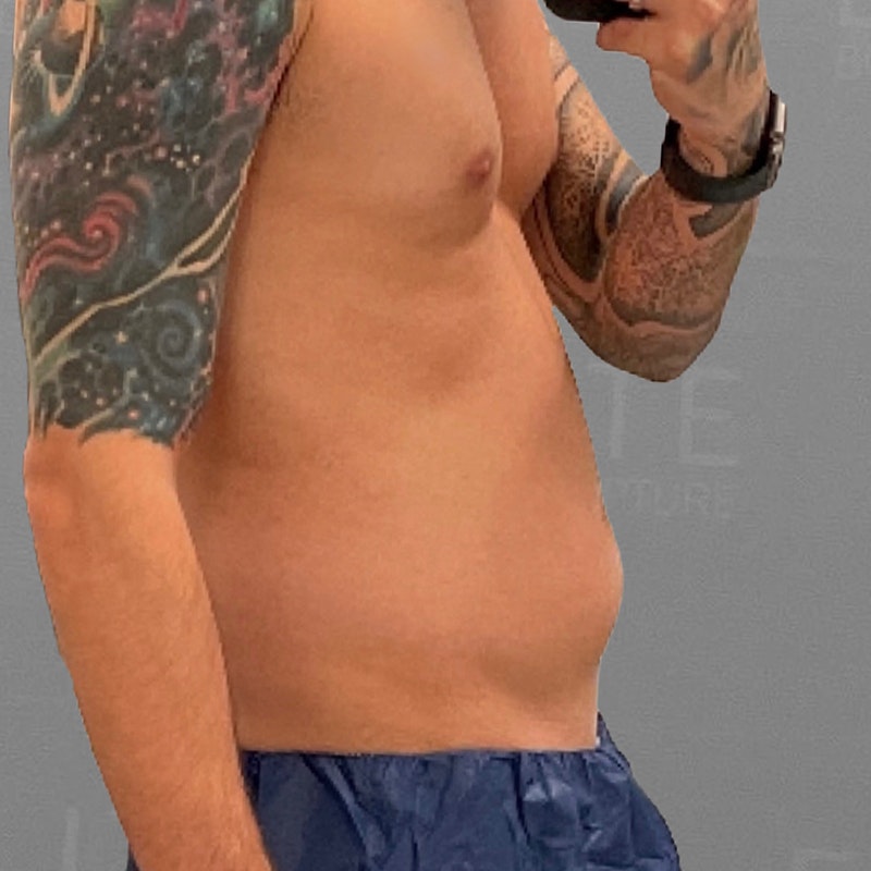 eric vaughn pre-op