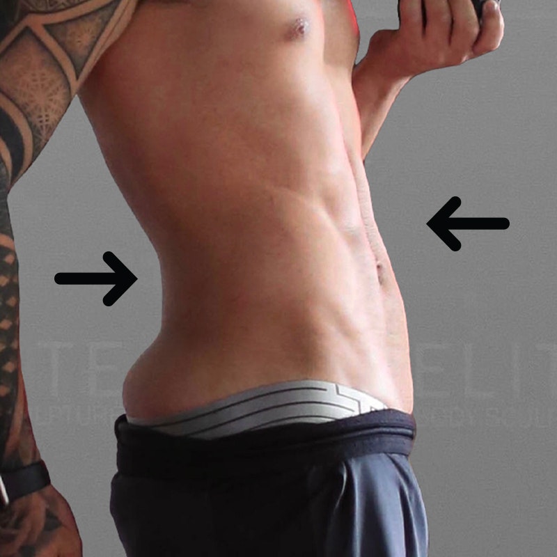eric vaughn post-op