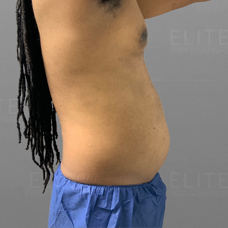 48-Hour Abs Before