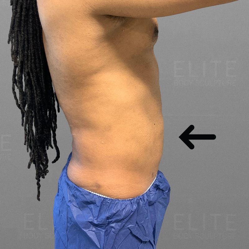48-Hour Abs After