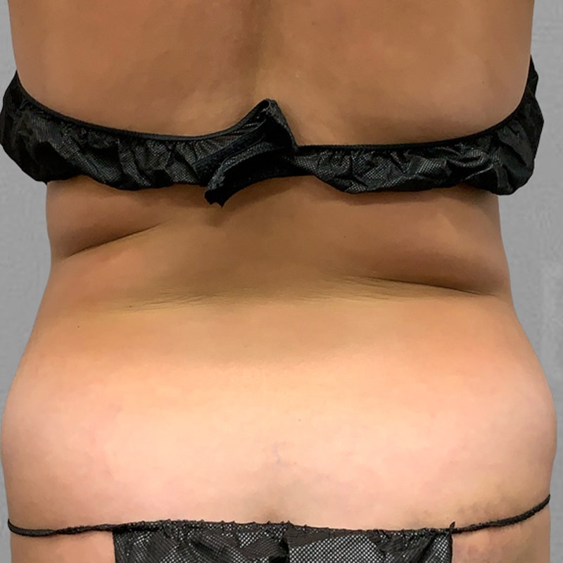 Chloe Trautman Back Before