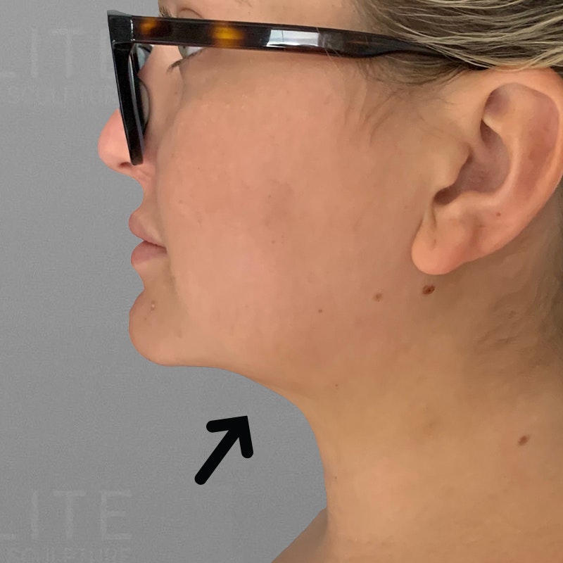 Chloe Trautman Chin After