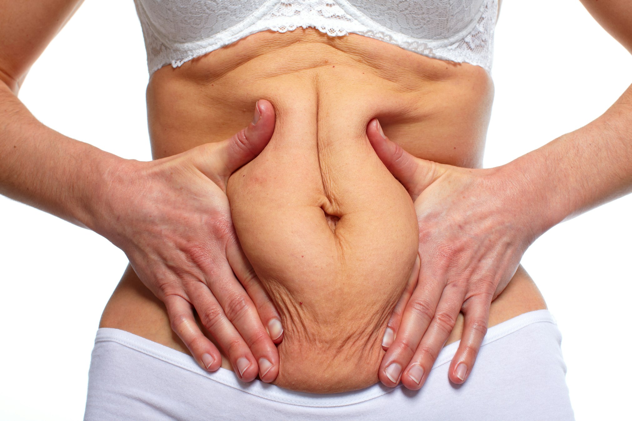 Is an Abdominoplasty Also A Weight-Loss Solution?