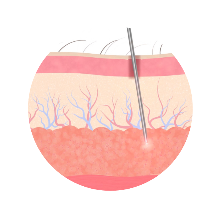 procedure4