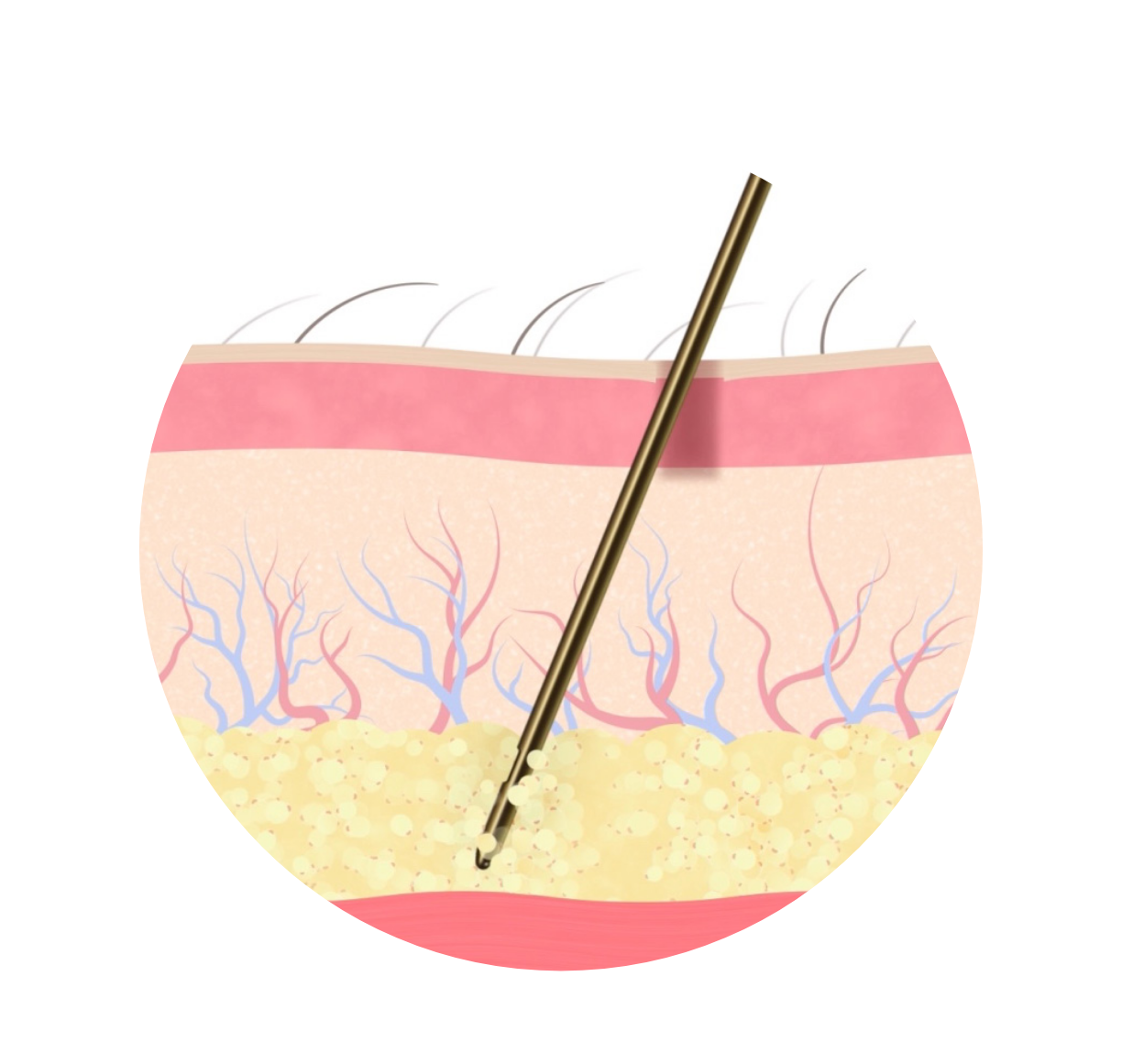 procedure5