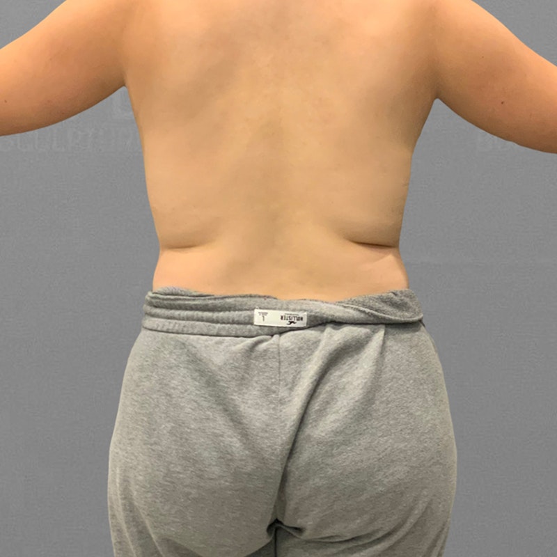 before back airsculpt+