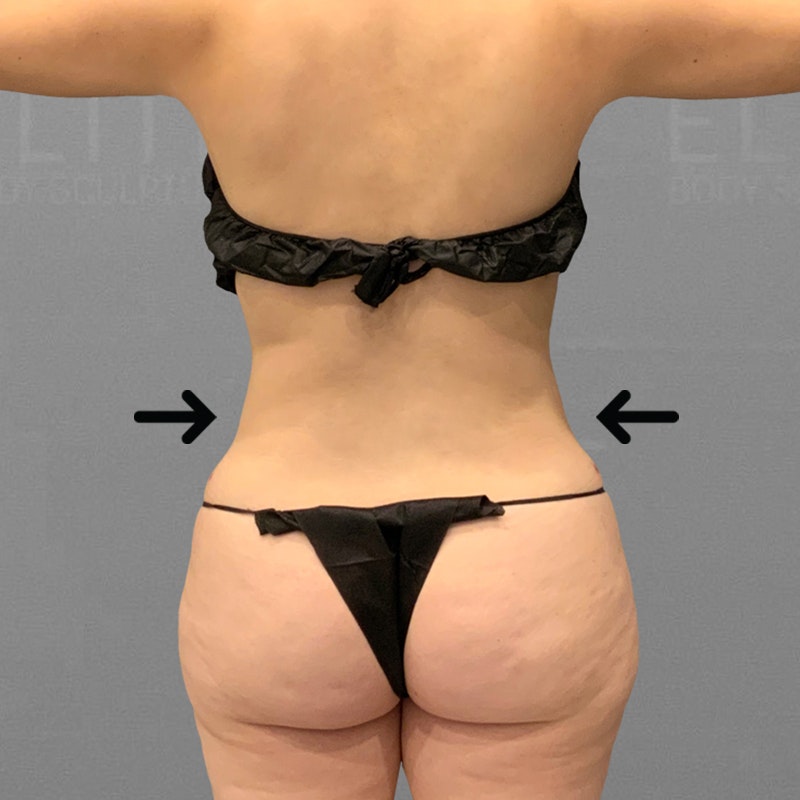 after back airsculpt+