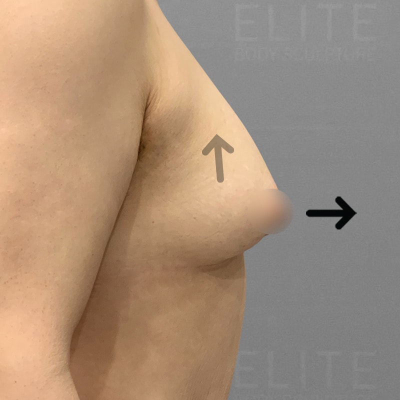 after airsculpt up a cup