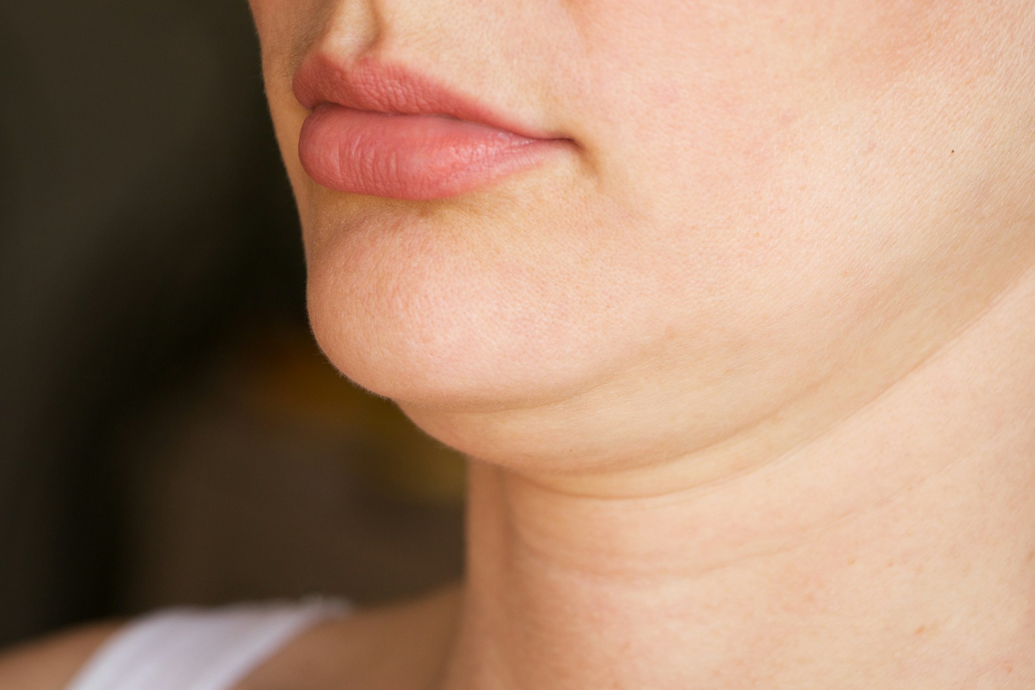 Chin Liposuction and Alternatives To Look Into For Utah Residents 